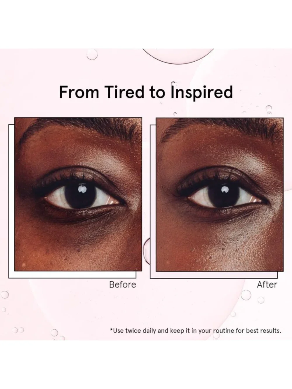 Cooling Under Eye Brightener with Metal Rollerball - Puffiness & Dark Circles